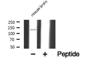 Western blot analysis of extracts from mouse brain , using DGKD antibody. (DGKD 抗体  (N-Term))