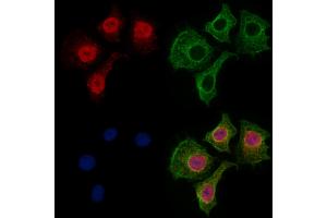 ABIN7094569 and ABIN7098618 staining HepG2 cells by IF/ICC. (Spt6 抗体  (C-Term))