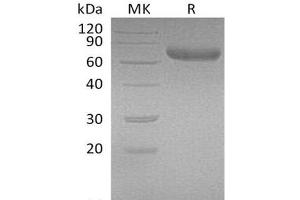 Western Blotting (WB) image for Prolactin Receptor (PRLR) protein (Fc Tag) (ABIN7320784)