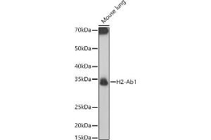Western blot analysis of extracts of Mouse lung, using H2-Ab1 antibody (ABIN7267665) at 1:1000 dilution. (H2-AB1 抗体)