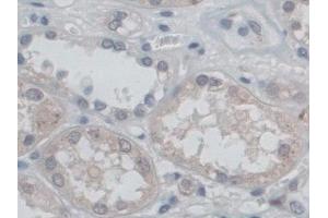 Detection of CD209 in Human Kidney Tissue using Polyclonal Antibody to Cluster Of Differentiation 209 (CD209) (DC-SIGN/CD209 抗体  (AA 70-404))