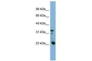Western Blot showing Crystallin Beta B3 antibody used at a concentration of 1-2 ug/ml to detect its target protein. (CRYBB3 抗体  (Middle Region))