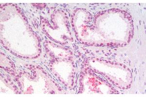 Immunohistochemistry (Paraffin-embedded Sections) (IHC (p)) image for anti-Cyclin-Dependent Kinase Inhibitor 1B (p27, Kip1) (CDKN1B) antibody (ABIN7249468)