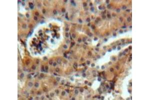 Used in DAB staining on fromalin fixed paraffin-embedded Kidney tissue (SOSTDC1 抗体  (AA 24-206))