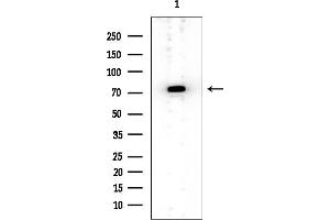 anti-Rhophilin, rho GTPase Binding Protein 1 (RHPN1) (C-Term) antibody