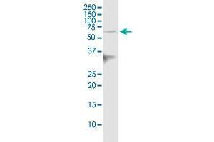 IGSF8 polyclonal antibody (A01). (IGSF8 抗体  (AA 220-322))