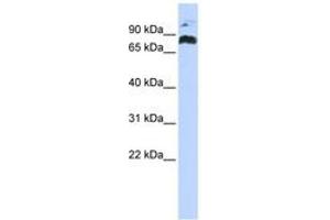 Image no. 1 for anti-PHD Finger Protein 21A (PHF21A) (AA 324-373) antibody (ABIN6742488) (PHF21A 抗体  (AA 324-373))