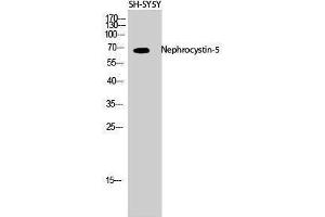Western Blotting (WB) image for anti-IQ Motif Containing B1 (IQCB1) (Internal Region) antibody (ABIN3185822) (IQCB1 抗体  (Internal Region))