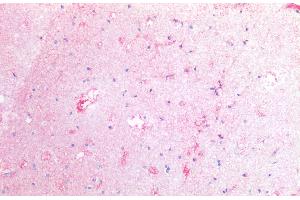 Immunohistochemistry staining of human cortex (paraffin-embedded sections) with anti-CD142 (HTF-1), 10 μg/mL. (Tissue factor 抗体)
