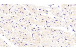 Detection of CDHH in Human Cardiac Muscle Tissue using Polyclonal Antibody to Cadherin, Heart (CDHH) (Cadherin 13 抗体  (AA 23-133))