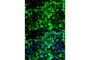 Immunofluorescence analysis of HeLa cells using TPM1 antibody (ABIN2989338). (Tropomyosin 抗体)