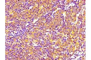 Immunohistochemistry of paraffin-embedded human lymph node tissue using ABIN7169699 at dilution of 1:100 (SIPA1 抗体  (AA 759-927))