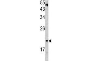 Western blot analysis of VHL antibody and HepG2 lysate. (VHL 抗体  (AA 181-210))