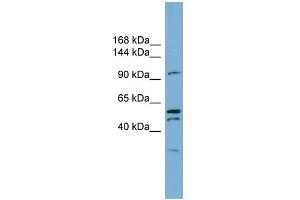 WB Suggested Anti-ANO6 Antibody Titration:  0. (Anoctamin 6 抗体  (C-Term))