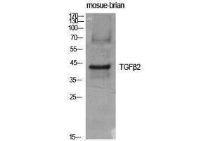 Western Blotting (WB) image for anti-Transforming Growth Factor, beta 2 (TGFB2) (C-Term) antibody (ABIN3187250) (TGFB2 抗体  (C-Term))