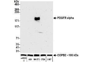 Western Blotting (WB) image for anti-Platelet Derived Growth Factor Receptor alpha (PDGFRA) (AA 24-525) antibody (ABIN7453344) (Recombinant PDGFRA 抗体  (AA 24-525))