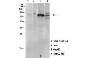 Western Blot (WB) analysis of specific cells using Antibody diluted at 1:1000. (MAPKAP Kinase 5 抗体  (pThr182))