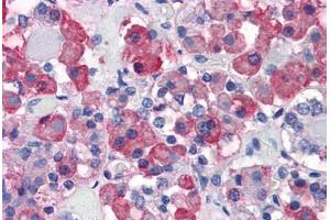 Anterior pituitary: Formalin-Fixed, Paraffin-Embedded (FFPE) (Growth Hormone 1 抗体)