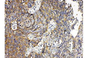 IHC analysis of RANK using anti- RANK antibody .