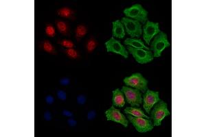ABIN7094868 and ABIN7098920 staining Hela cells by IF/ICC.