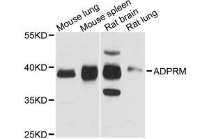Western blot analysis of extracts of various cell lines, using ADPRM antibody. (ADPRM 抗体)