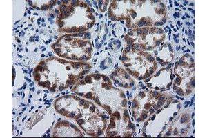 Immunohistochemical staining of paraffin-embedded Human Kidney tissue using anti-GCKR mouse monoclonal antibody. (GCKR 抗体)