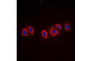 Immunofluorescent analysis of PDGFR alpha staining in NIH3T3 cells. (PDGFRA 抗体  (C-Term))
