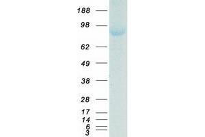 Validation with Western Blot