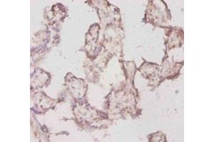 Immunohistochemistry of paraffin-embedded human placenta tissue using ABIN7177935 at dilution of 1:20 (TPT1 抗体  (AA 1-172))