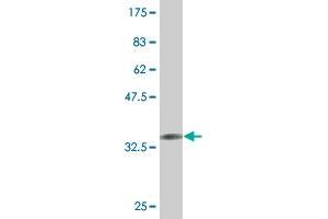 Western Blot detection against Immunogen (36. (ALAS1 抗体  (AA 1-98))