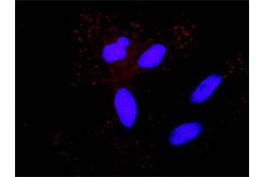 Proximity Ligation Analysis of protein-protein interactions between MAP3K5 and APP. (ASK1 抗体  (AA 1-1374))