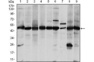 Western Blotting (WB) image for anti-Argininosuccinate Synthase 1 (ASS1) antibody (ABIN1105454) (ASS1 抗体)