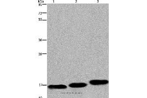 Western blot analysis of Mouse skeletal muscle, heart and bladder tissue, using MYL12B Polyclonal Antibody at dilution of 1:550 (MYL12B 抗体)