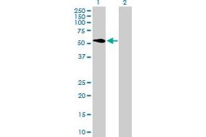 Western Blot analysis of ATP6V1H expression in transfected 293T cell line by ATP6V1H MaxPab polyclonal antibody. (ATP6V1H 抗体  (AA 1-483))