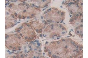 Detection of PDIA4 in Human Stomach Tissue using Polyclonal Antibody to Protein Disulfide Isomerase A4 (PDIA4) (PDIA4 抗体  (AA 505-636))