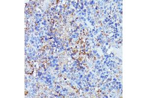 Immunohistochemistry of paraffin-embedded rat spleen using Septin 1 antibody (ABIN7270202) at dilution of 1:100 (40x lens). (Septin 1 抗体  (AA 270-370))