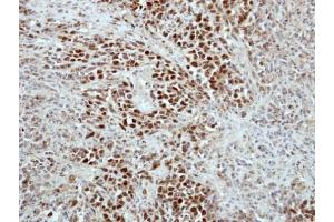 Immunohistochemistry (IHC) image for anti-Telomeric Repeat Binding Factor 2, Interacting Protein (TERF2IP) (Center) antibody (ABIN2855248)