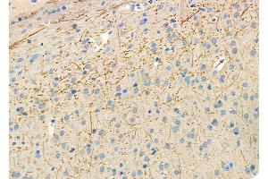 ABIN6257771 and ABIN6275570 at 1/100 staining Mouse brain tissue by IHC-P.
