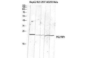 Western Blot (WB) analysis of HepG2 823-AV 293T AD293 HeLa lysis using PGLYRP1 antibody. (PGLYRP1 抗体)