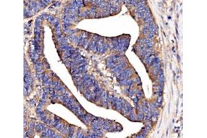 IHC analysis of SCRN1 using anti-SCRN1 antibody (ABIN7602923). (Secernin 1 抗体  (C-Term))
