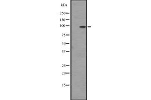 Western blot analysis of DDR2 expression in Hela cell lysate,The lane on the left is treated with the antigen-specific peptide. (DDR2 抗体  (Internal Region))