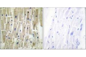 Immunohistochemistry analysis of paraffin-embedded human heart tissue, using PDLIM1 Antibody. (PDLIM1 抗体  (AA 61-110))
