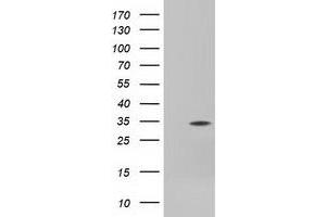 Western Blotting (WB) image for anti-Four and A Half LIM Domains 1 (FHL1) antibody (ABIN1500977) (FHL1 抗体)