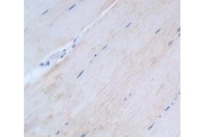 Used in DAB staining on fromalin fixed paraffin- embedded Kidney tissue (HSF4 抗体  (AA 91-407))