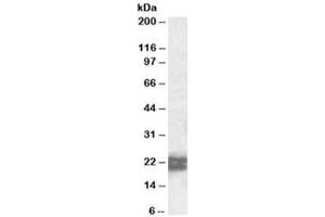 Western blot testing of human testis lysate with NPC2 antibody at 0. (NPC2 抗体)