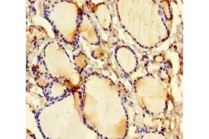 Immunohistochemistry of paraffin-embedded human thyroid tissue using ABIN7153665 at dilution of 1:100 (Non-Syndromic Hearing Impairment Protein 5 (GSDME) (AA 1-496) 抗体)