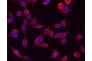 Immunofluorescence (IF) image for anti-Keratin 1 (KRT1) antibody (ABIN2664915) (Cytokeratin 1 抗体)