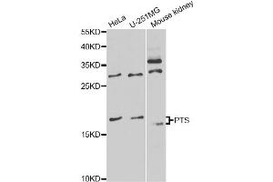 Western blot analysis of extracts of various cell lines, using PTS antibody (ABIN6291724) at 1:1000 dilution. (PTS 抗体)