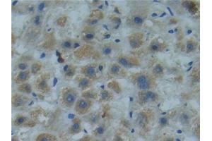 Immunohistochemistry (IHC) image for anti-SMAD Family Member 9 (SMAD9) (AA 226-459) antibody (ABIN7442282)