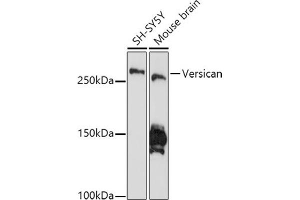 Versican 抗体